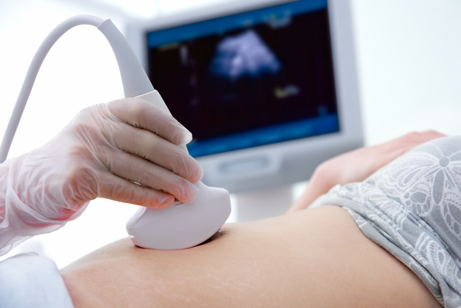 caring-svc-ultrasound